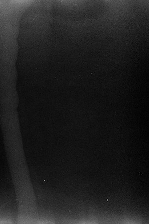 15 María Fernanda Santizo  - B&W Kodak Portra 400 con Rayos X por Arca Film Lab (Abril 2024)