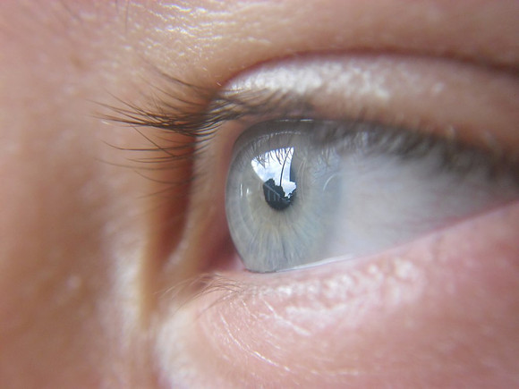 ojo de anna stadlober